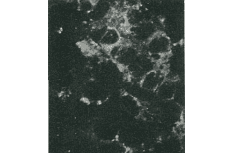 Detection of HCV NS4a protein by immunofluorescence antibody staining. Chimp liver cells were infected with recombinant vaccinia virus containing a HCV genome cDNA. After incubation for 48 hr, the cells were fixed with acetone and HCV NS4a protein was detected by indirect immunofluorescence staining using this antibody. 