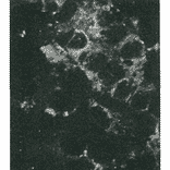 Detection of HCV NS4a protein by immunofluorescence antibody staining. Chimp liver cells were infected with recombinant vaccinia virus containing a HCV genome cDNA. After incubation for 48 hr, the cells were fixed with acetone and HCV NS4a protein was detected by indirect immunofluorescence staining using this antibody. 