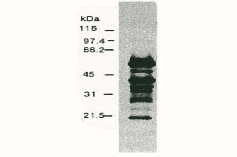 Western blotting of HCV NS5a protein. 