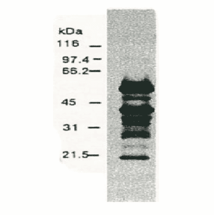 Western blotting of HCV NS5a protein. 