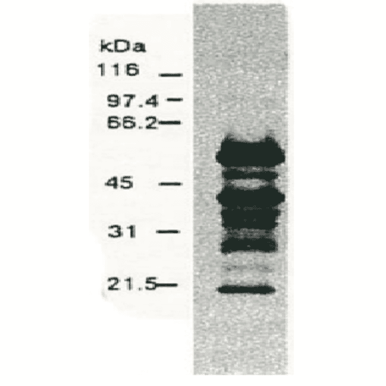 Western blotting of HCV NS5a protein. 
