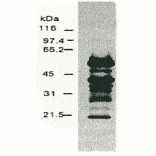 Western blotting of HCV NS5a protein. 