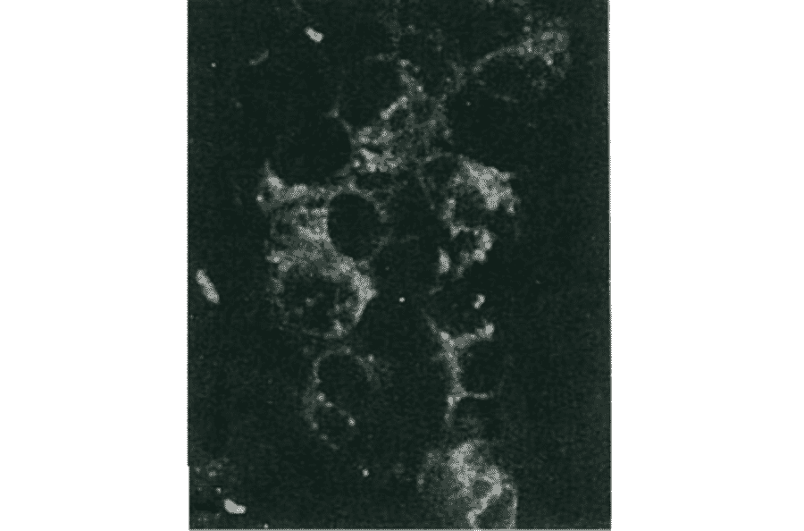 Detection of HCV NS5a protein by immunofluorescence antibody staining. 