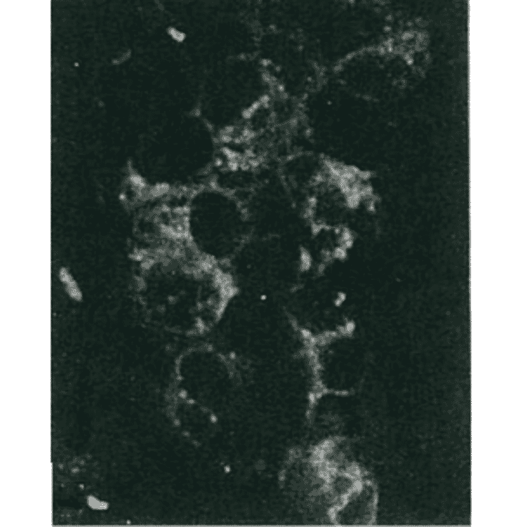 Detection of HCV NS5a protein by immunofluorescence antibody staining. 