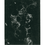 Detection of HCV NS5a protein by immunofluorescence antibody staining. 