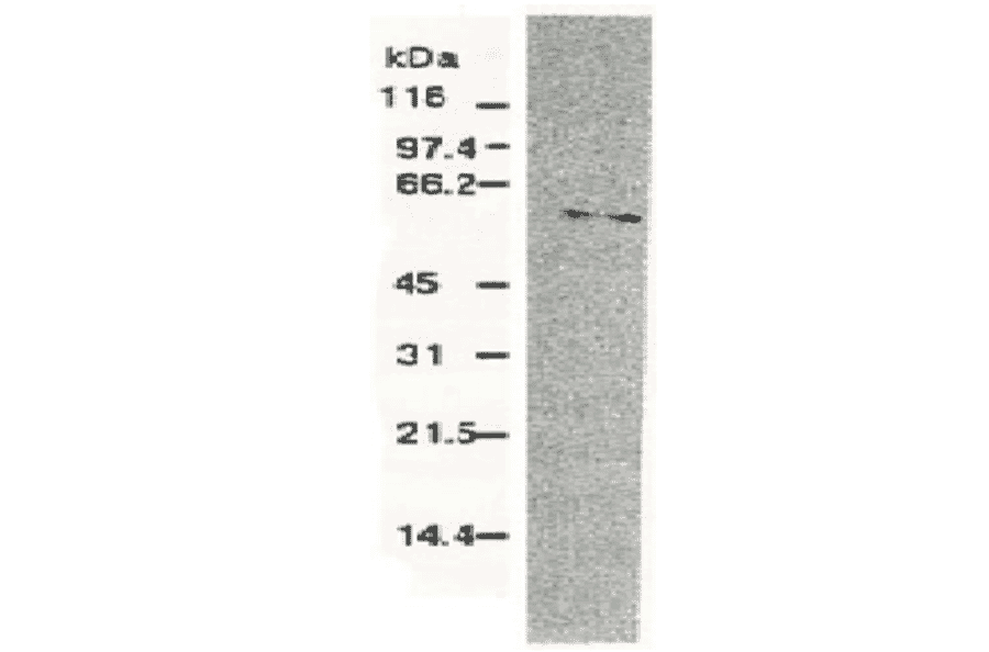 Western blotting of HCV NS5b protein.