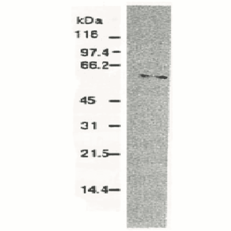 Western blotting of HCV NS5b protein.