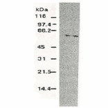 Western blotting of HCV NS5b protein.
