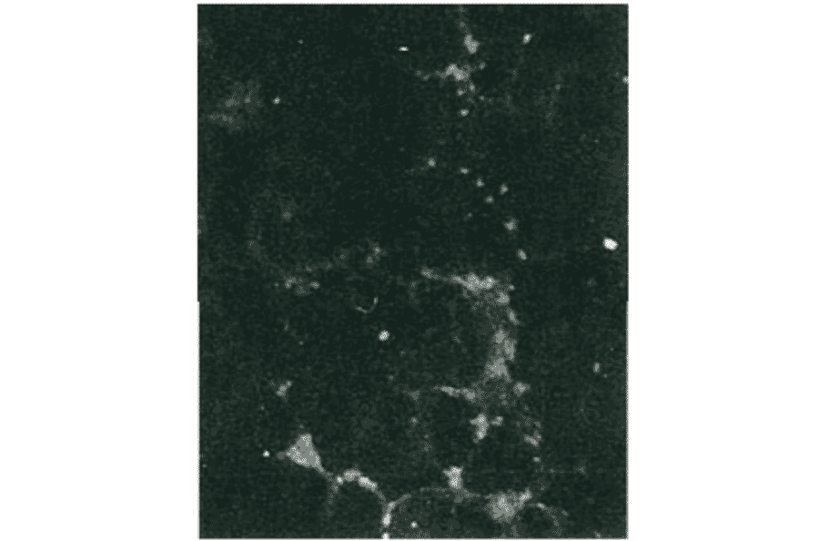 Detection of HCV NS5b protein by immunofluorescence antibody staining.
