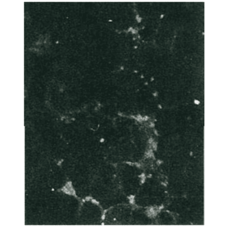 Detection of HCV NS5b protein by immunofluorescence antibody staining.