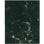 Detection of HCV NS5b protein by immunofluorescence antibody staining.