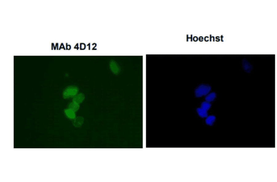 Immunofluorescence staining of SUMO-1 with the antibody 4D12 in the mouse primary culture neurons. 