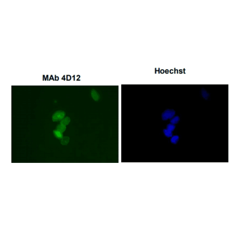 Immunofluorescence staining of SUMO-1 with the antibody 4D12 in the mouse primary culture neurons. 