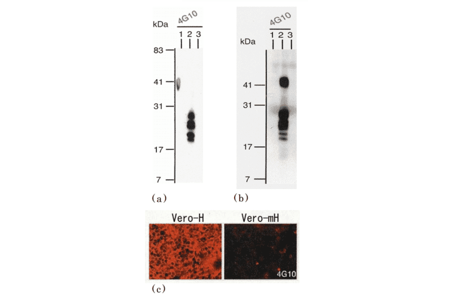 Identification of human HB Identification of human HB-EGF by using anti EGF by using anti EGF by using anti-HB-EGF (clone 4G10) (clone 4G10) clone 4G10)