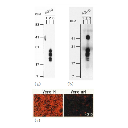 Identification of human HB Identification of human HB-EGF by using anti EGF by using anti EGF by using anti-HB-EGF (clone 4G10) (clone 4G10) clone 4G10)