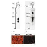 Identification of human HB Identification of human HB-EGF by using anti EGF by using anti EGF by using anti-HB-EGF (clone 4G10) (clone 4G10) clone 4G10)