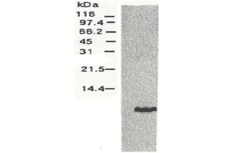 Western blotting of HCV NS4a protein. 