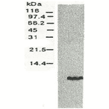 Western blotting of HCV NS4a protein. 