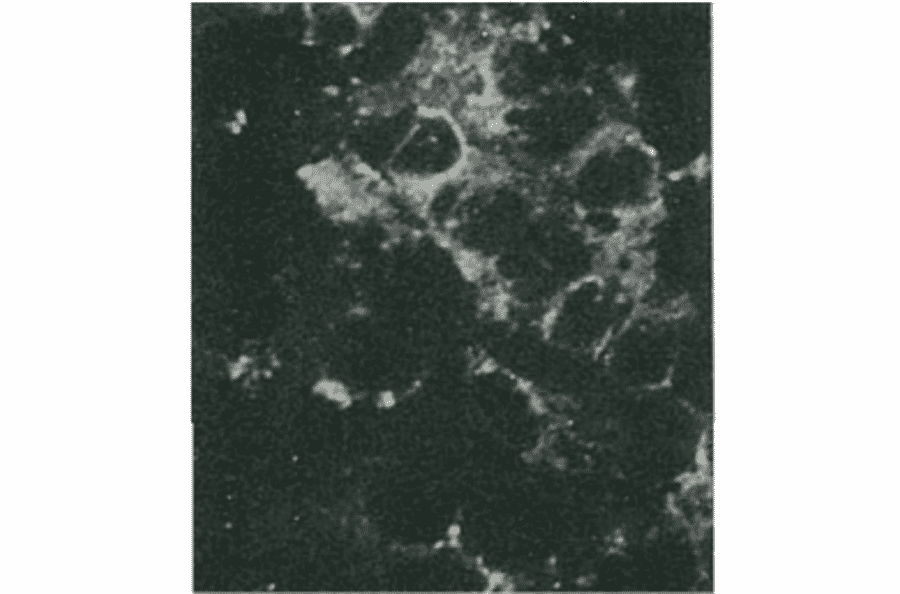 Detection of HCV NS4a protein by immunofluorescence antibody staining. 