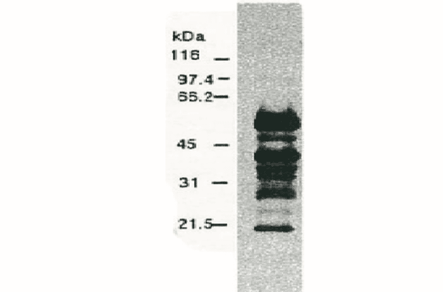 Western blotting of HCV NS5a protein.Chimp liver cells were infected with recombinant vaccinia virus containing a HCV genome cDNA and were subjected to Western blotting using the anti-NS5a antibody. The multitude of NS5a-specific products must be the degraded products of NS5a protein (52 kD). 