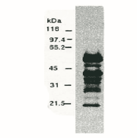 Western blotting of HCV NS5a protein.Chimp liver cells were infected with recombinant vaccinia virus containing a HCV genome cDNA and were subjected to Western blotting using the anti-NS5a antibody. The multitude of NS5a-specific products must be the degraded products of NS5a protein (52 kD). 