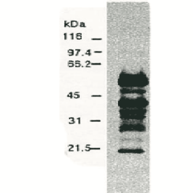Western blotting of HCV NS5a protein.Chimp liver cells were infected with recombinant vaccinia virus containing a HCV genome cDNA and were subjected to Western blotting using the anti-NS5a antibody. The multitude of NS5a-specific products must be the degraded products of NS5a protein (52 kD). 