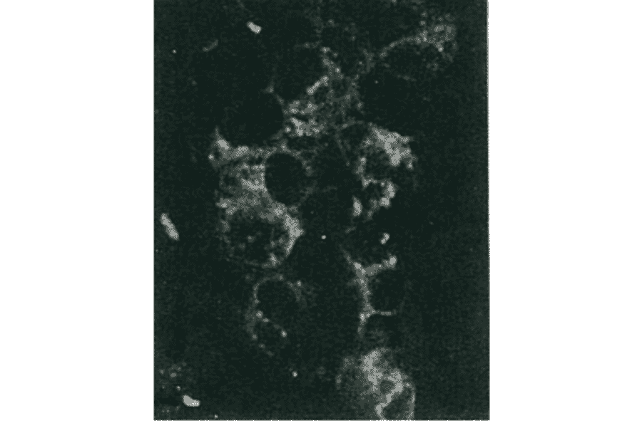 Detection of HCV NS5a protein by immunofluorescence antibody staining. 