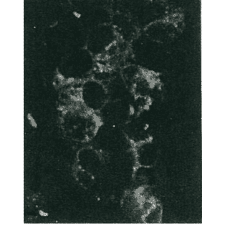Detection of HCV NS5a protein by immunofluorescence antibody staining. 
