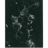 Detection of HCV NS5a protein by immunofluorescence antibody staining. 