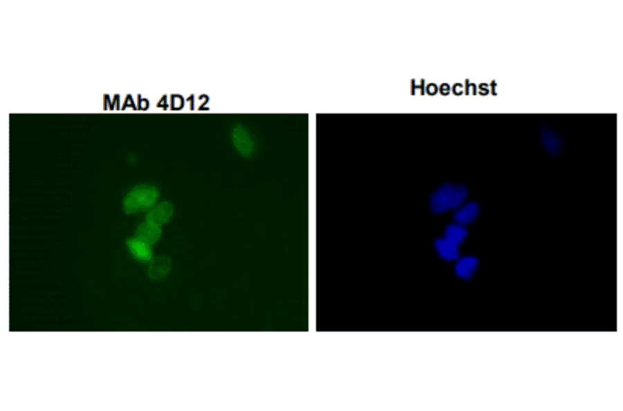 Immunofluorescence staining ofSUMO-1 with the antibody 4D12 in the mouse primary culture neurons. 