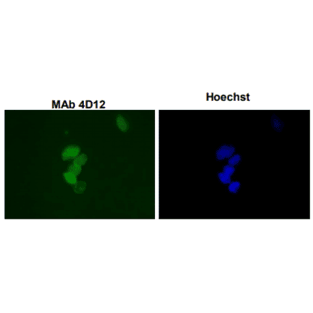 Immunofluorescence staining ofSUMO-1 with the antibody 4D12 in the mouse primary culture neurons. 