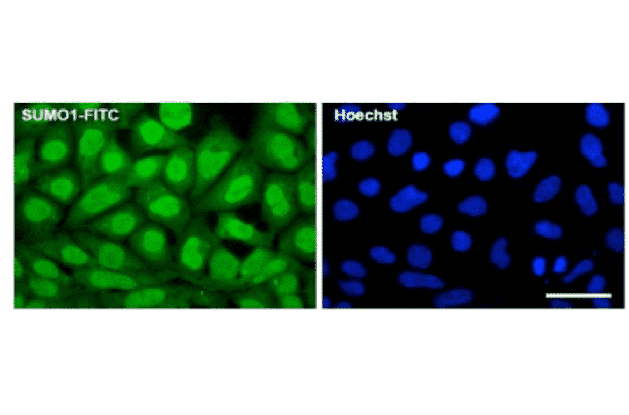Fluorescence immunocytochemistry for endogenous SUMO1 expression. 