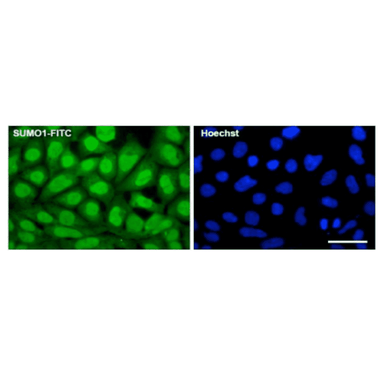 Fluorescence immunocytochemistry for endogenous SUMO1 expression. 