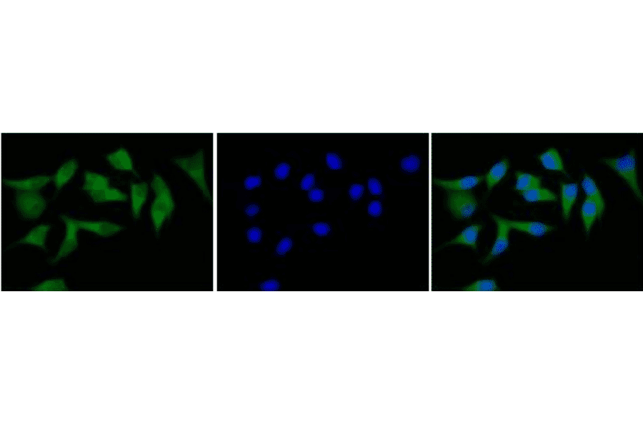 Immunofluorescence staining of CD40 in MCF7 cells with FITC-conjugated anti-CD40 antibody.