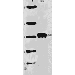 Western blot analysis of Rad51 in HeLa cell extract with Anti-Rad51 Antibody.