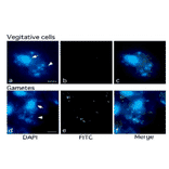Methylation of chloroplast DNA visualized by immunochemistry 