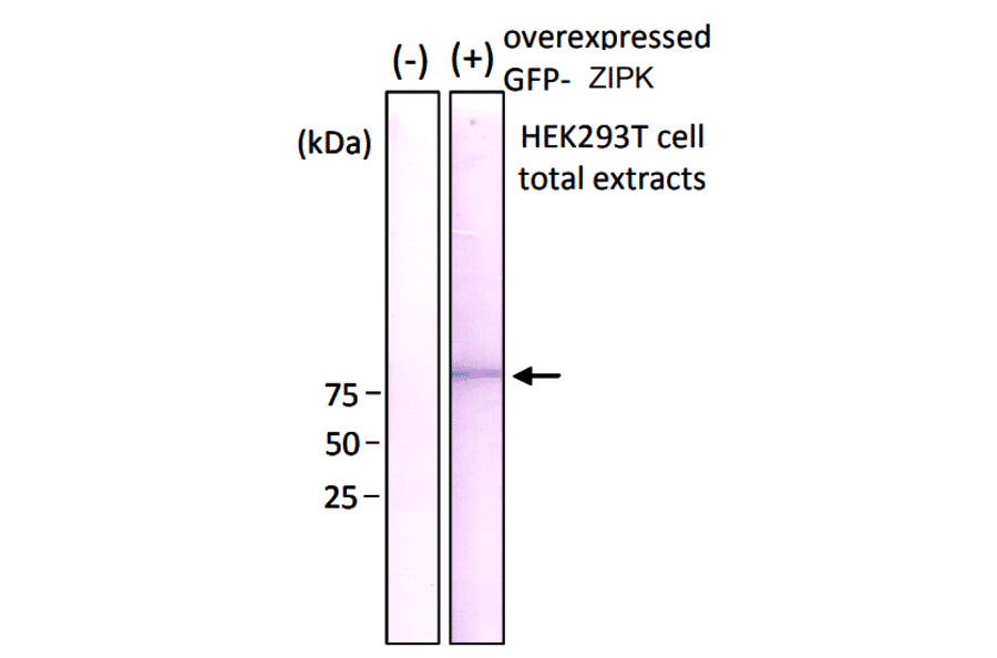 Western blot analysis of GFP-ZIPK fusion protein over-expressed in HEK293 cells using Anti-GFP Antibody [1A5].
