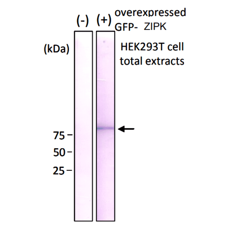 Western blot analysis of GFP-ZIPK fusion protein over-expressed in HEK293 cells using Anti-GFP Antibody [1A5].