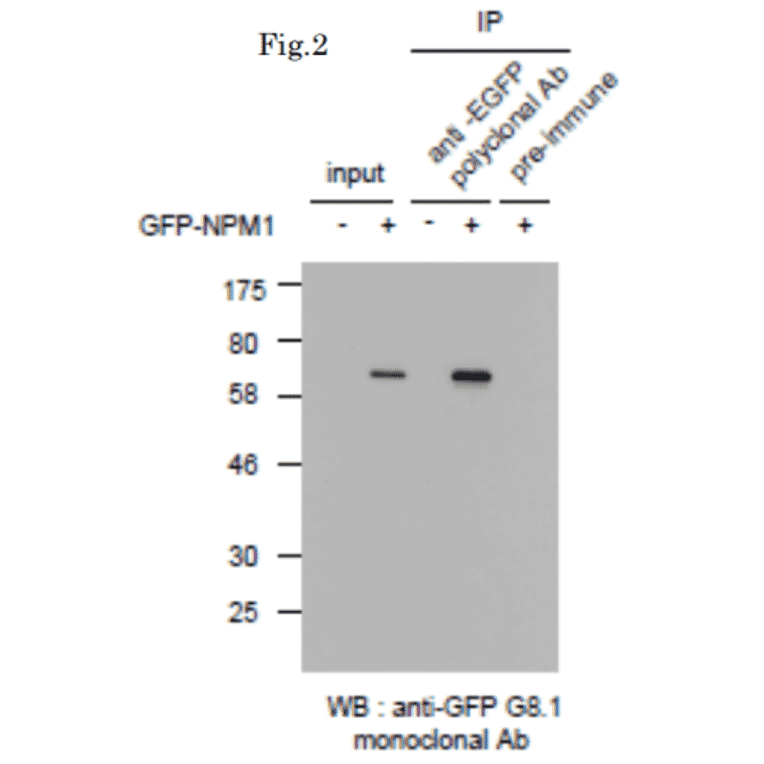Immunoprecipitation of GFP-tagged protein with Anti-GFP Antibody followed by western blotting. Lysate of 293T cells transfected with an empty vector (-). Lysate of 293T cells transfected with the plasmid carrying the GFP-tagged NPM1 gene (+).