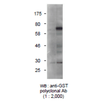 Detection of GST-tagged protein with Anti-GST Antibody by western blotting. Lysate of 293T cells transfected with an empty vector (-). Lysate of 293T cells transfected with the plasmid carrying the GST-tagged importin gene (+).