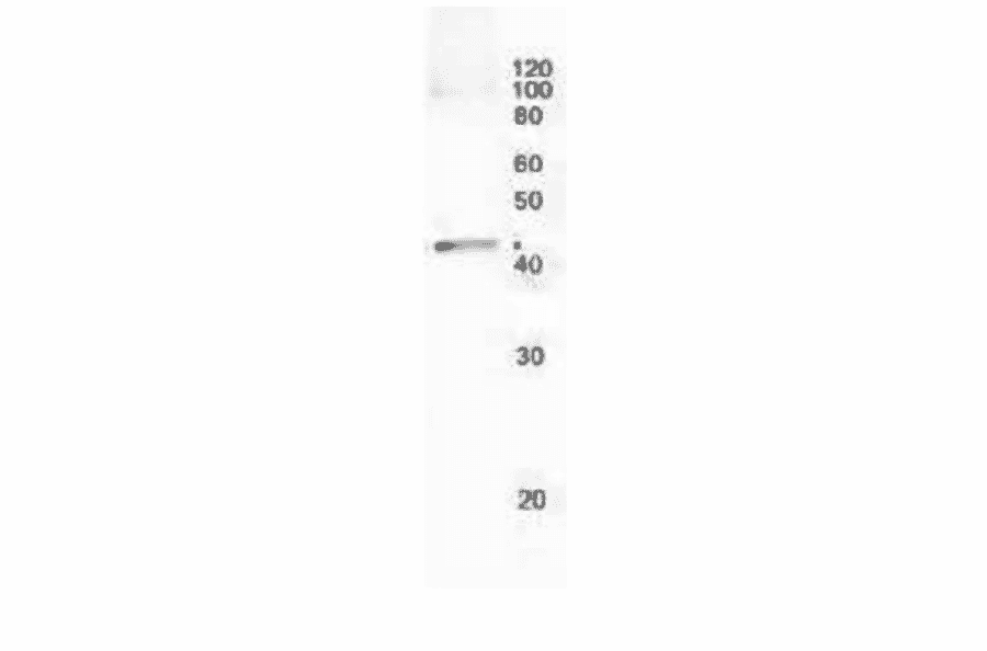 Immunoprecipitation of RecA protein from crude extract of E. coli cells. Anti-RecA Antibody (2µg) was adsorbed onto protein A magnetic beads to precipitate RecA protein from supernatant of sonic disrupted E. coli cells. The precipitate was analyzed by western blot.