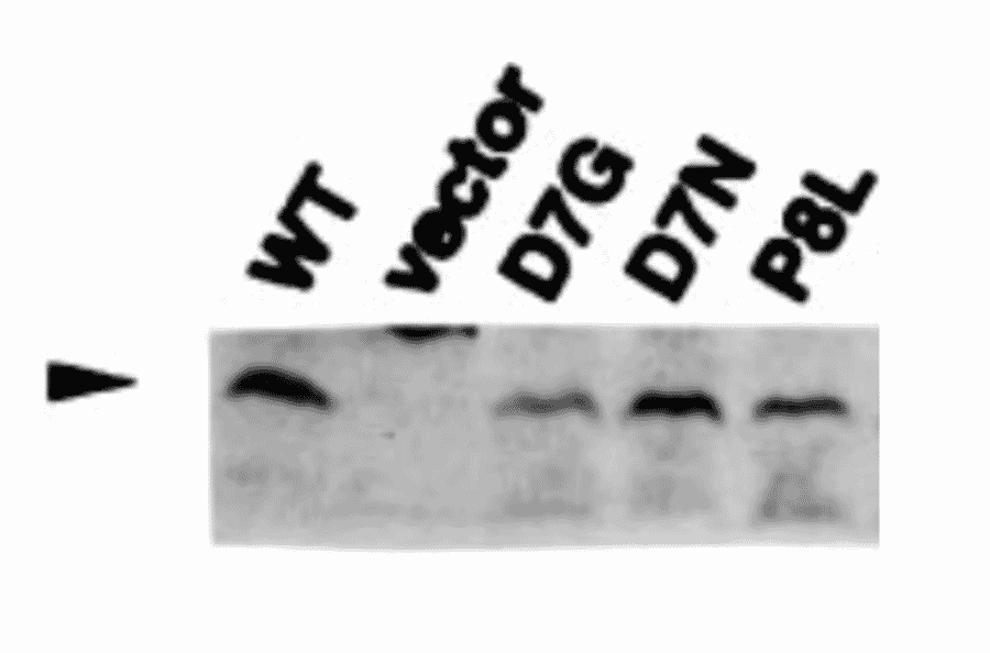 Detection of RuvC (19kD) proteins in the cell extracts of E. coli carrying the plasmids which encode the indicated mutant RuvC proteins by western blotting using Anti-RuvC Antibody.
