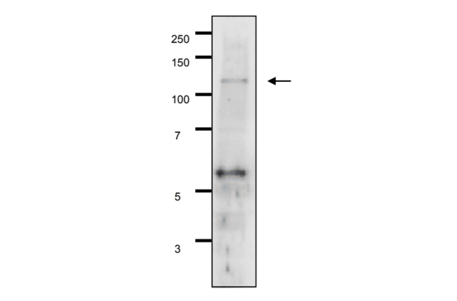 Detection of Gal11p by Western blotting using the Gal11p antibody in the whole cell extract of S. cerevisiae The antiserum was used at 1/500 dilution. 7.5% gradient gel was used and wet system was used for blotting.