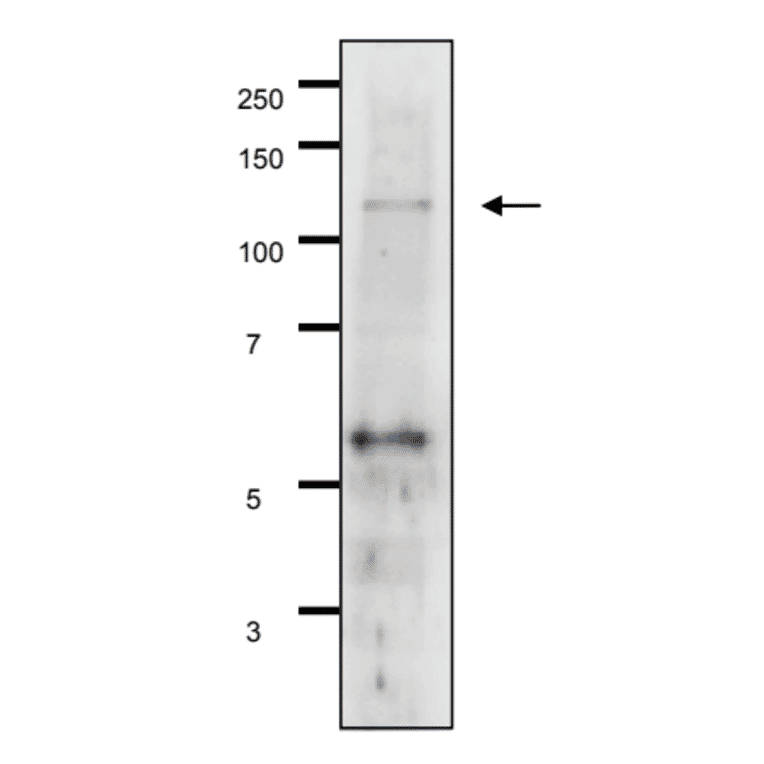 Detection of Gal11p by Western blotting using the Gal11p antibody in the whole cell extract of S. cerevisiae The antiserum was used at 1/500 dilution. 7.5% gradient gel was used and wet system was used for blotting.