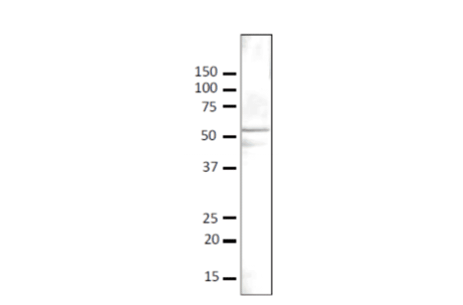 Detection of Gcn5 protein in crude lysate of S. cerevisiae strain BY4741 by western blotting with anti-Gcn5 antibody. Anti-Gcn5 antibody was used at 1/500 dilution and 2nd antibody, goat anti-rabbit IgG antibody conjugated with HRP, was used at 1/5,000 dilution. Signal enhancer, “CanGet Sigbnal” (Toyobo, Osaka), was used. Numbers on the left are positions of protein bands in kDa. Molecular mass of Gcn5 is 51 kDa.