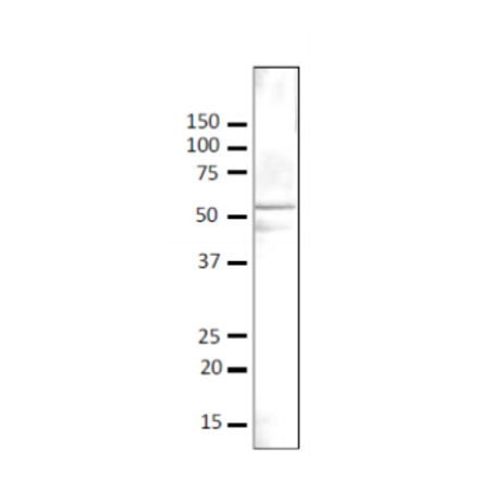 Detection of Gcn5 protein in crude lysate of S. cerevisiae strain BY4741 by western blotting with anti-Gcn5 antibody. Anti-Gcn5 antibody was used at 1/500 dilution and 2nd antibody, goat anti-rabbit IgG antibody conjugated with HRP, was used at 1/5,000 dilution. Signal enhancer, “CanGet Sigbnal” (Toyobo, Osaka), was used. Numbers on the left are positions of protein bands in kDa. Molecular mass of Gcn5 is 51 kDa.