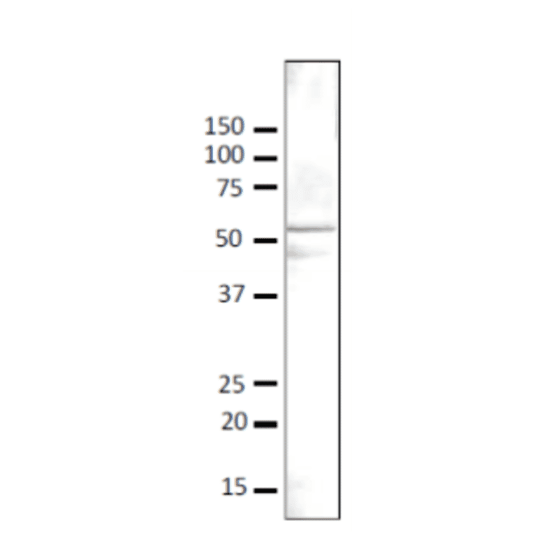 Detection of Gcn5 protein in crude lysate of S. cerevisiae strain BY4741 by western blotting with anti-Gcn5 antibody. Anti-Gcn5 antibody was used at 1/500 dilution and 2nd antibody, goat anti-rabbit IgG antibody conjugated with HRP, was used at 1/5,000 dilution. Signal enhancer, “CanGet Sigbnal” (Toyobo, Osaka), was used. Numbers on the left are positions of protein bands in kDa. Molecular mass of Gcn5 is 51 kDa.