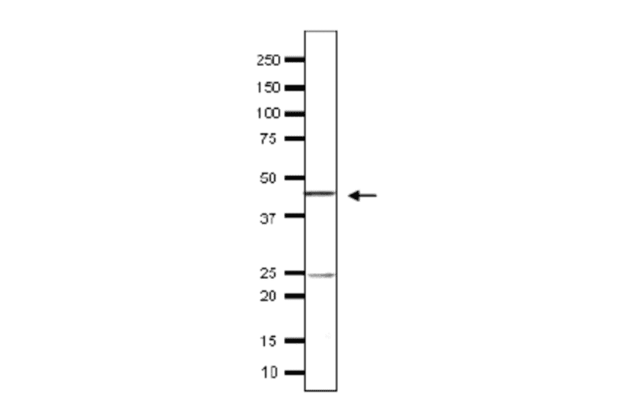 Detection of endogenous Taf11 in whole cell extract of S. cerevisiae by Western blotting, using the Taf11 antibody. The antiserum was used at 1/500 dilution