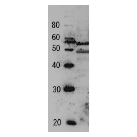 Detection of endogenous Tfg2 protein by Western blotting Protein size markers(kDa) Sample: Extract of budding yeast The antiserum was diluted 5,000 fold before use. The molecular mass of Tfg2 is 46.6 kDa.
