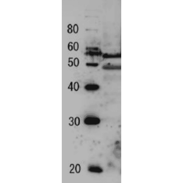 Detection of endogenous Tfg2 protein by Western blotting Protein size markers(kDa) Sample: Extract of budding yeast The antiserum was diluted 5,000 fold before use. The molecular mass of Tfg2 is 46.6 kDa.